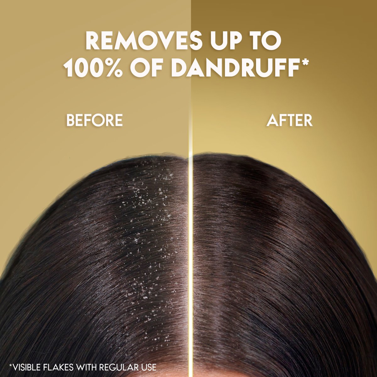Head & Shoulders Supreme Anti-Dandruff Shampoo with Argan Oil for Dry Scalp Rejuvenation 200 ml