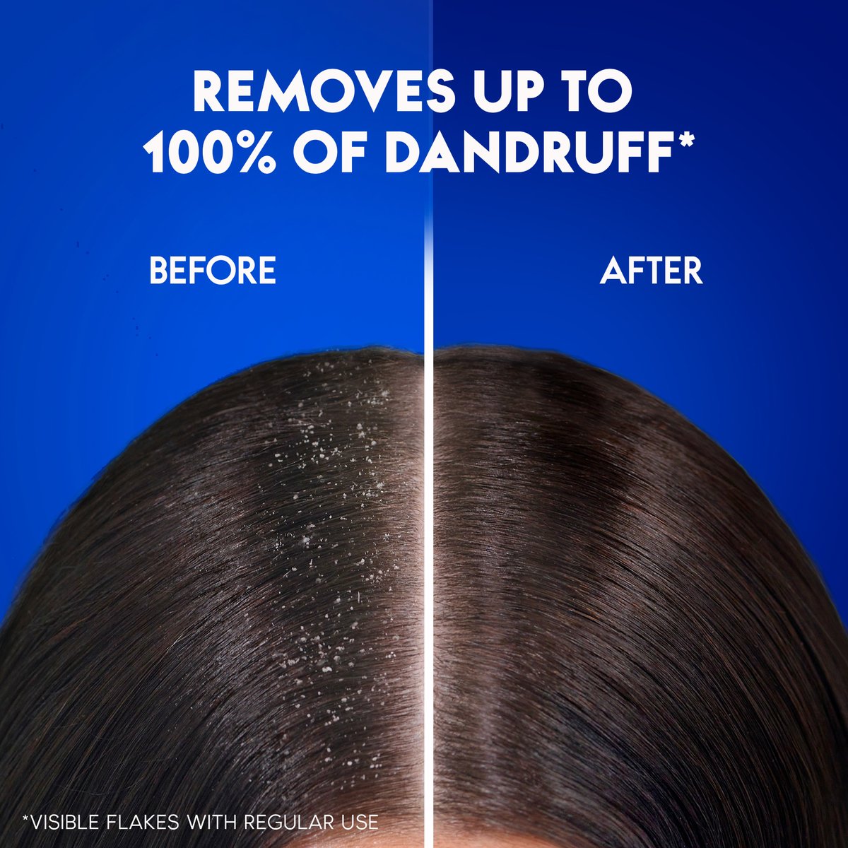 Head & Shoulders Classic Clean Anti-Dandruff Shampoo for Normal Hair 600 ml
