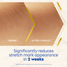 Nivea Luminous 630 Body Oil Serum Stretch Marks Reduction 100 ml